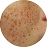 results sun spots
