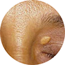 thermo circles depositsc