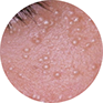 thermo circles milliac